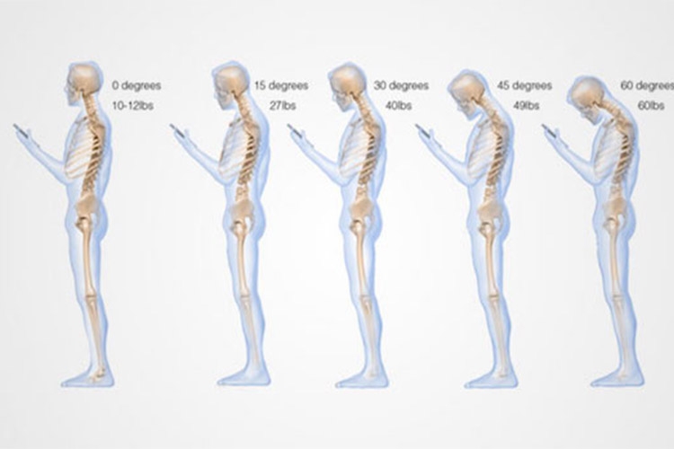 تاثیر استفاده از گوشی هوشمند روی ستون فقرات