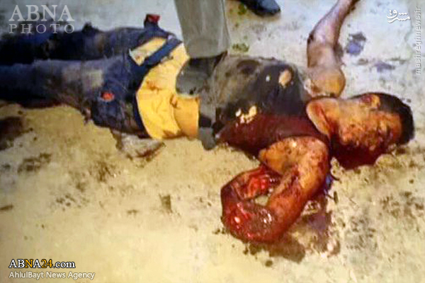 عکس/ جسد داعشی انتحاری در بغداد(18+)