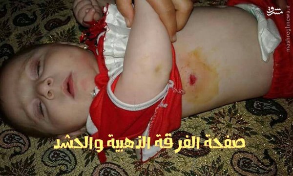 حمله شبه نظامیان بارزانی به آمبولانس مجروحان شیعه+عکس