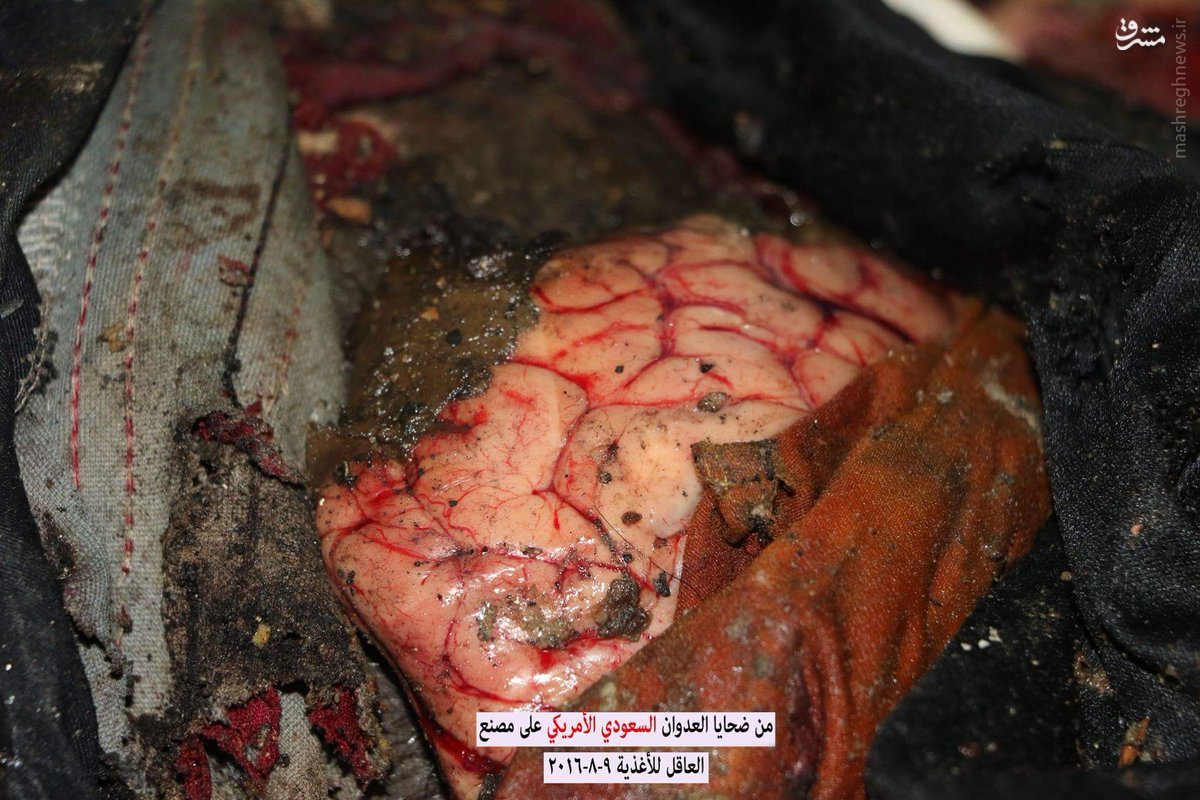 بمباران کارگاه مواد غذایی یمنی توسط هواپیماهای سعودی+عکس