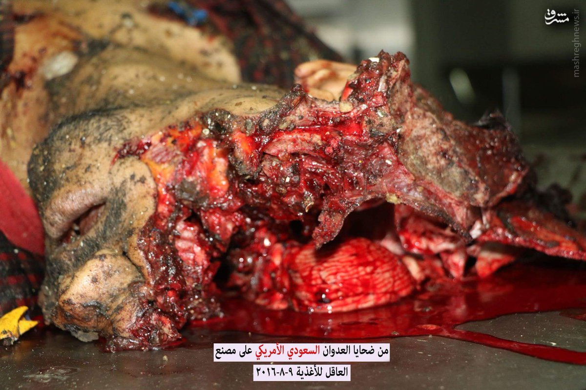 بمباران کارگاه مواد غذایی یمنی توسط هواپیماهای سعودی+عکس