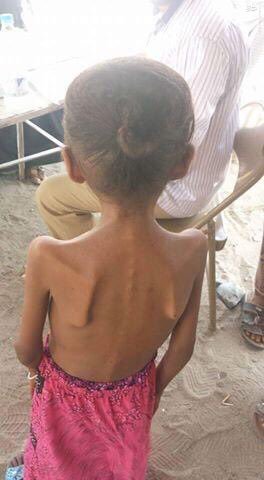 عجز آل سعود از برتری نظامی در یمن/آغاز مرحله جدید حملات موشکی انصارالله به خاک حجاز/گسترش نبردها در خاک عربستان/جنگ اقتصادی آمریکا و انگلیس علیه مردم یمن!/اماده برای ساعت 9 شب عجز آل سعود از برتری نظامی در یمن/آغاز مرحله جدید حملات موشکی انصارالله به خاک حجاز/گسترش نبردها در خاک عربستان/جنگ اقتصادی آمریکا و انگلیس علیه مردم یمن!/اماده برای ساعت 9 شب